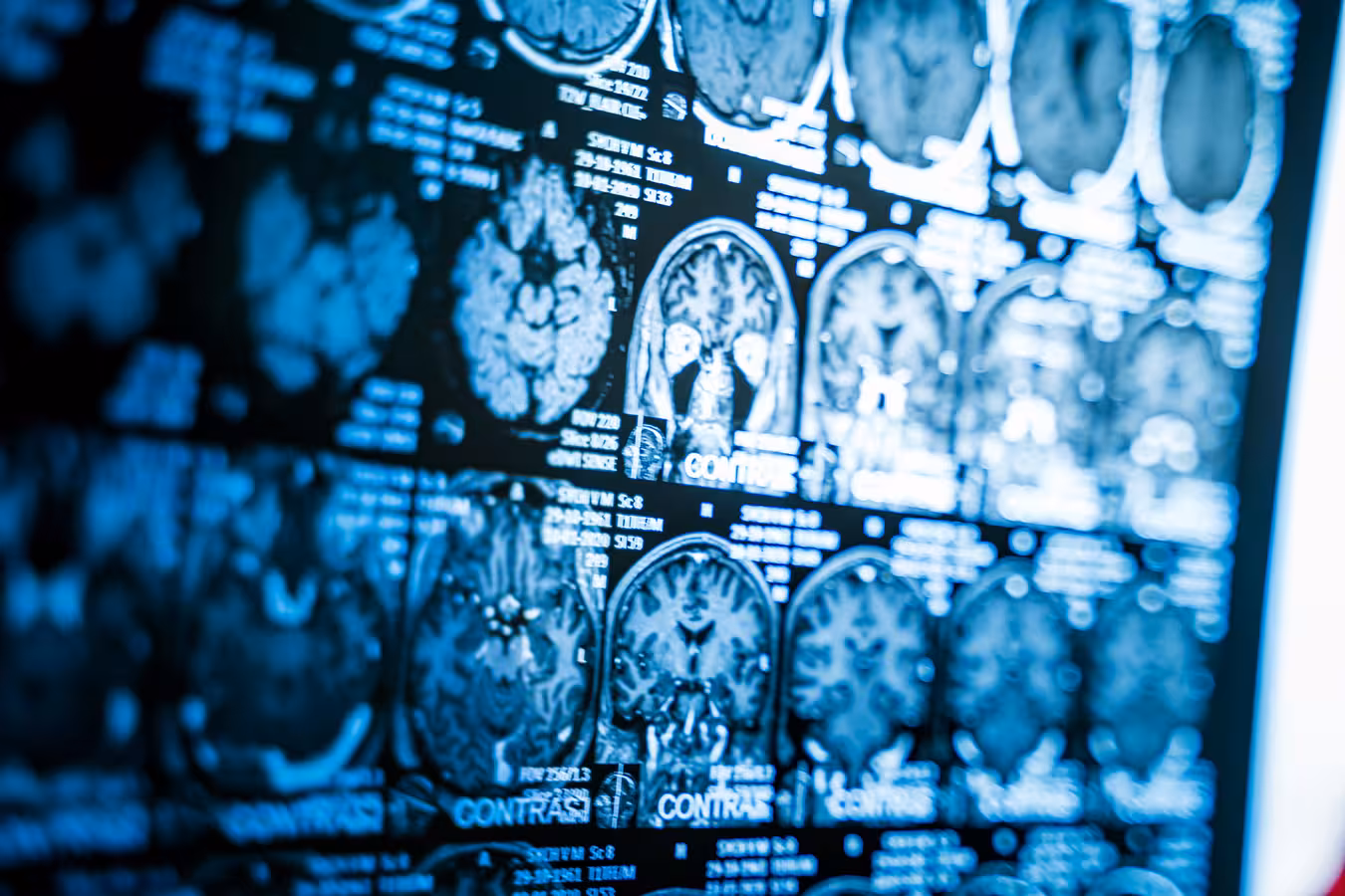 Glow Imaging specialist providing attentive diagnostic care